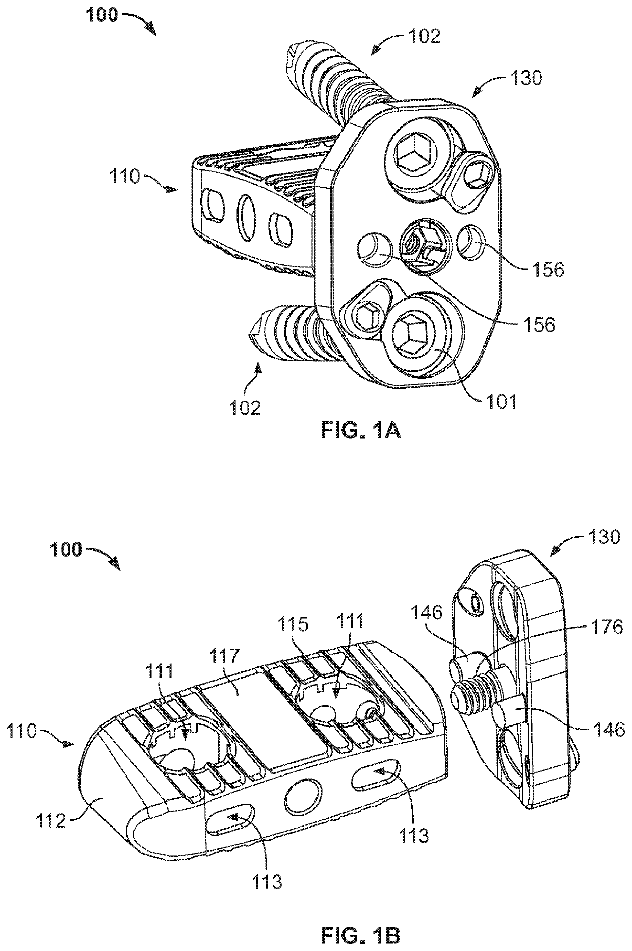 Intervertebral Implant Assembly and Instruments Therefor