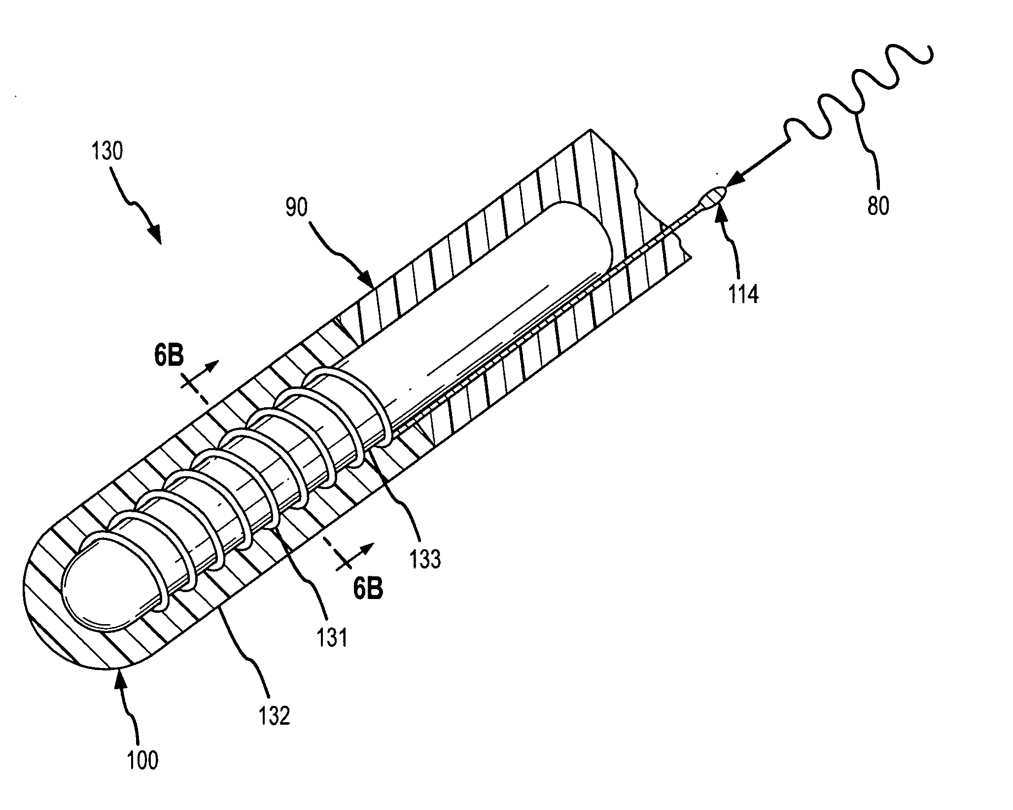 Pressure-sensitive conductive composite electrode and method for ablation