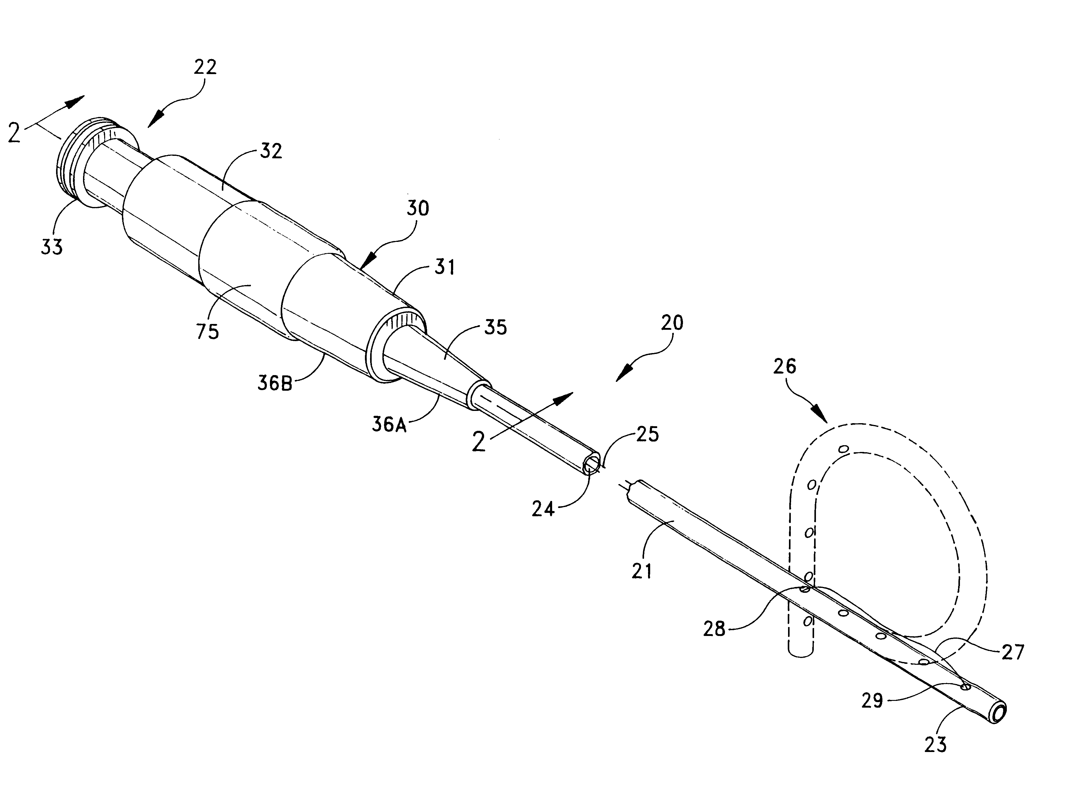 Suture retention device