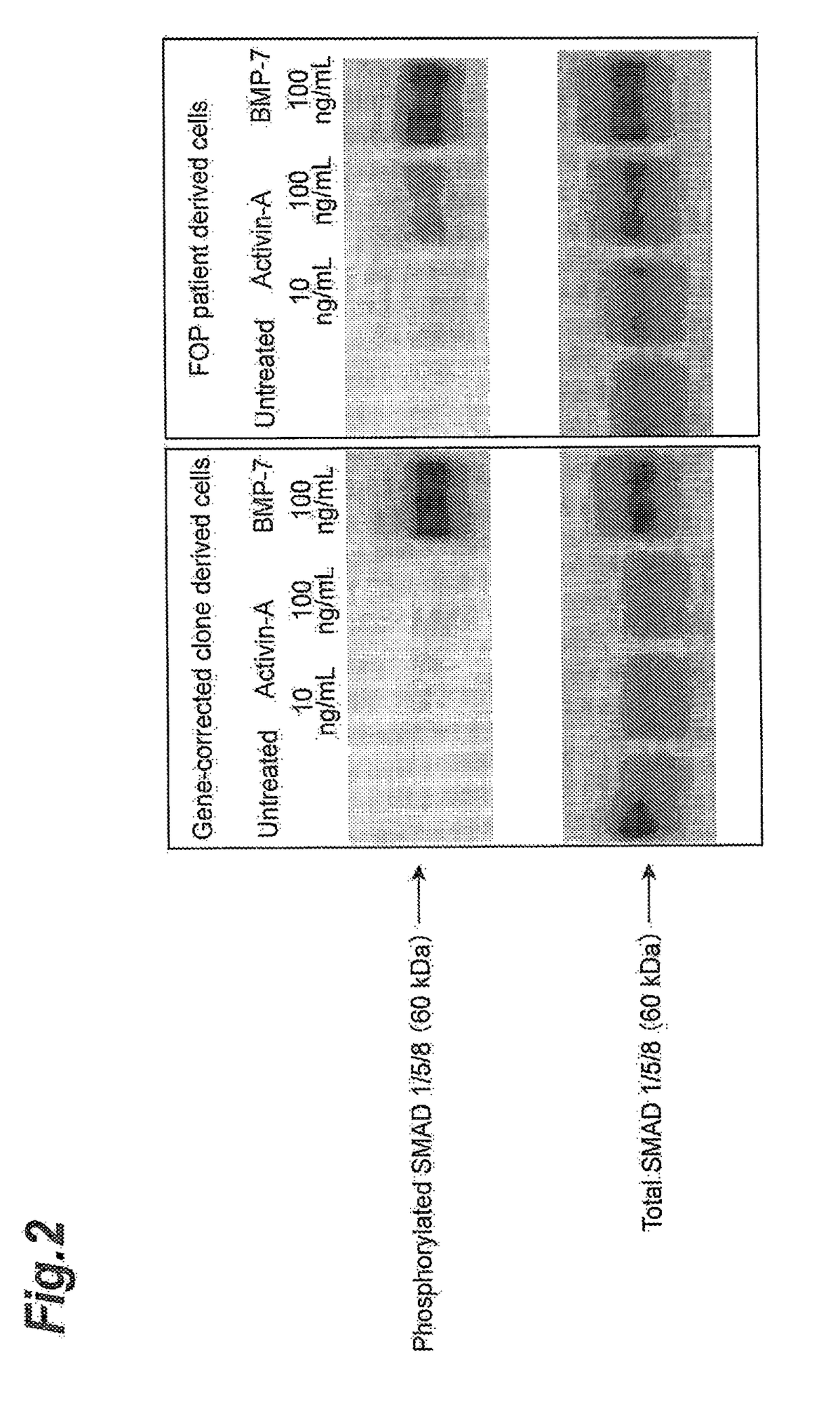 Prophylactic Agent and Therapeutic Agent for Fibrodysplasia Ossificans Progressiva