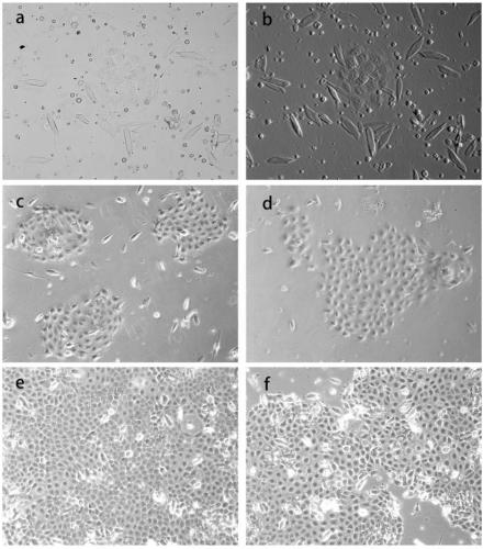 Isolated culture method of hair follicle stem cells of Yangtze River delta white goat