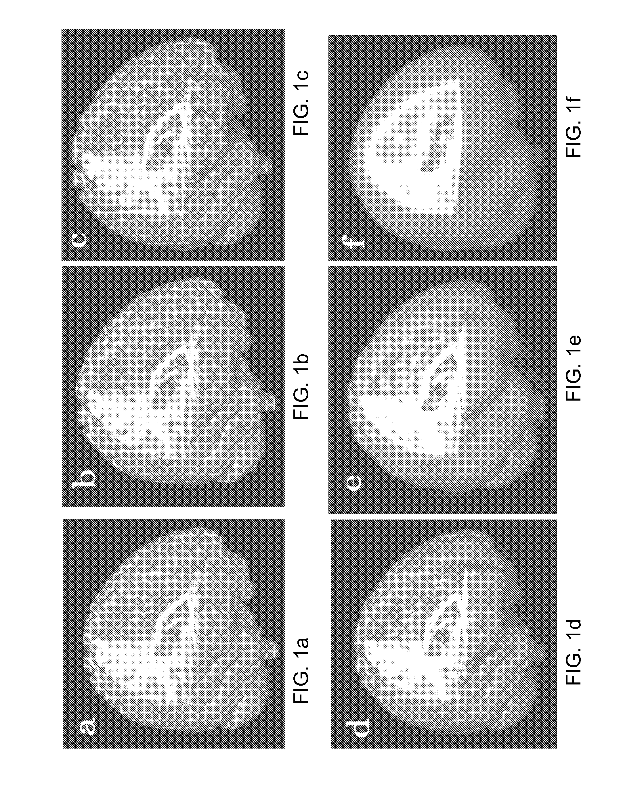 Method and system for analysis of volumetric data