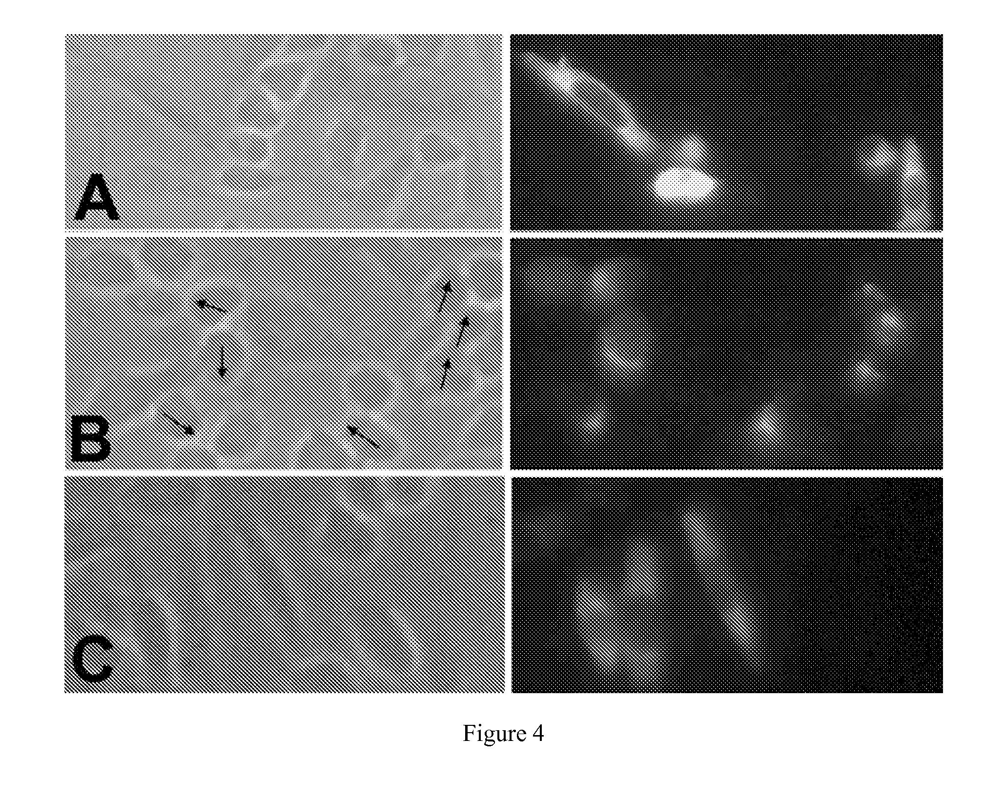 Compositions and methods for regulating sas1r