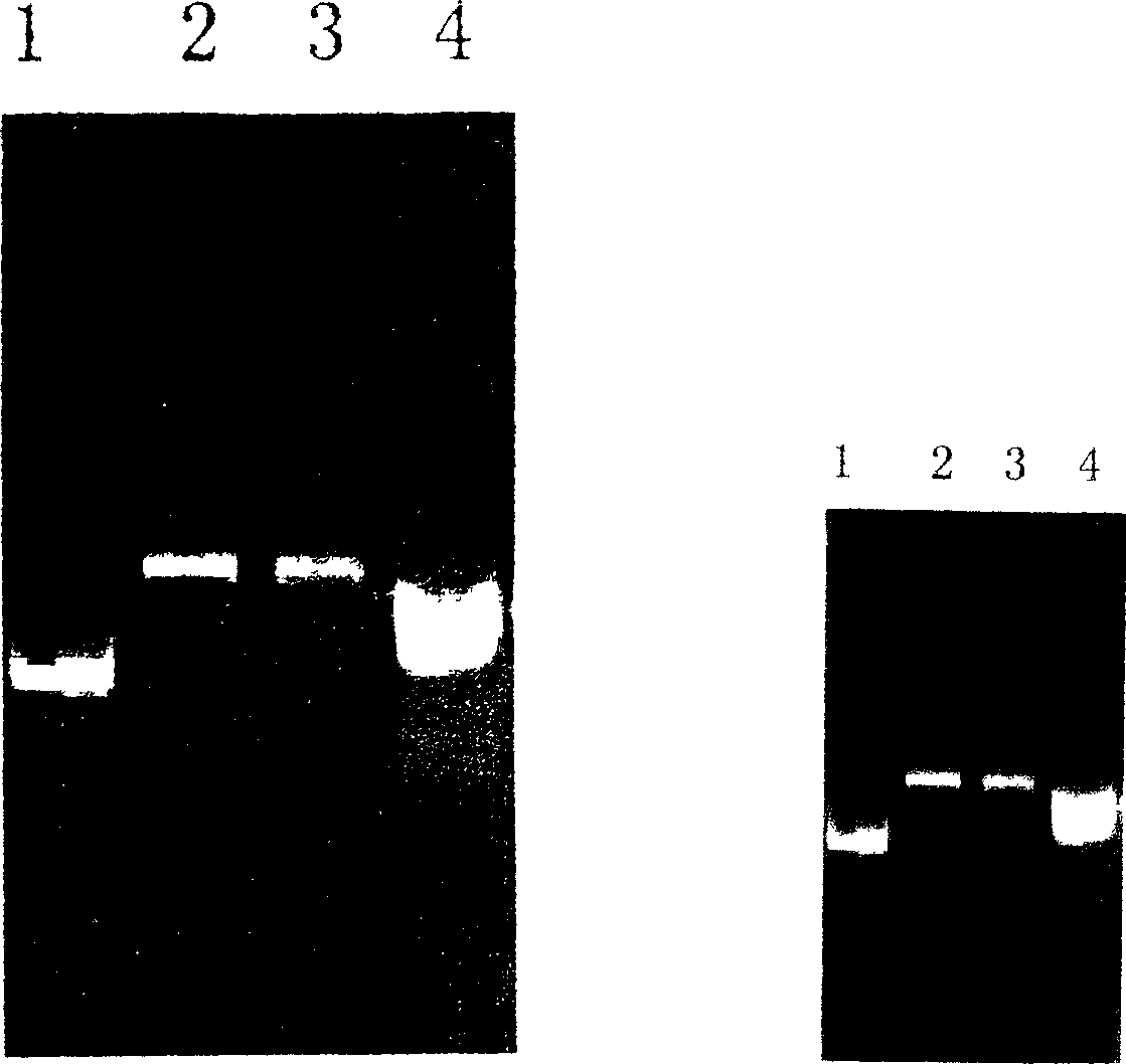 B hepatitis virus X protein transduction system expression vector and its construction