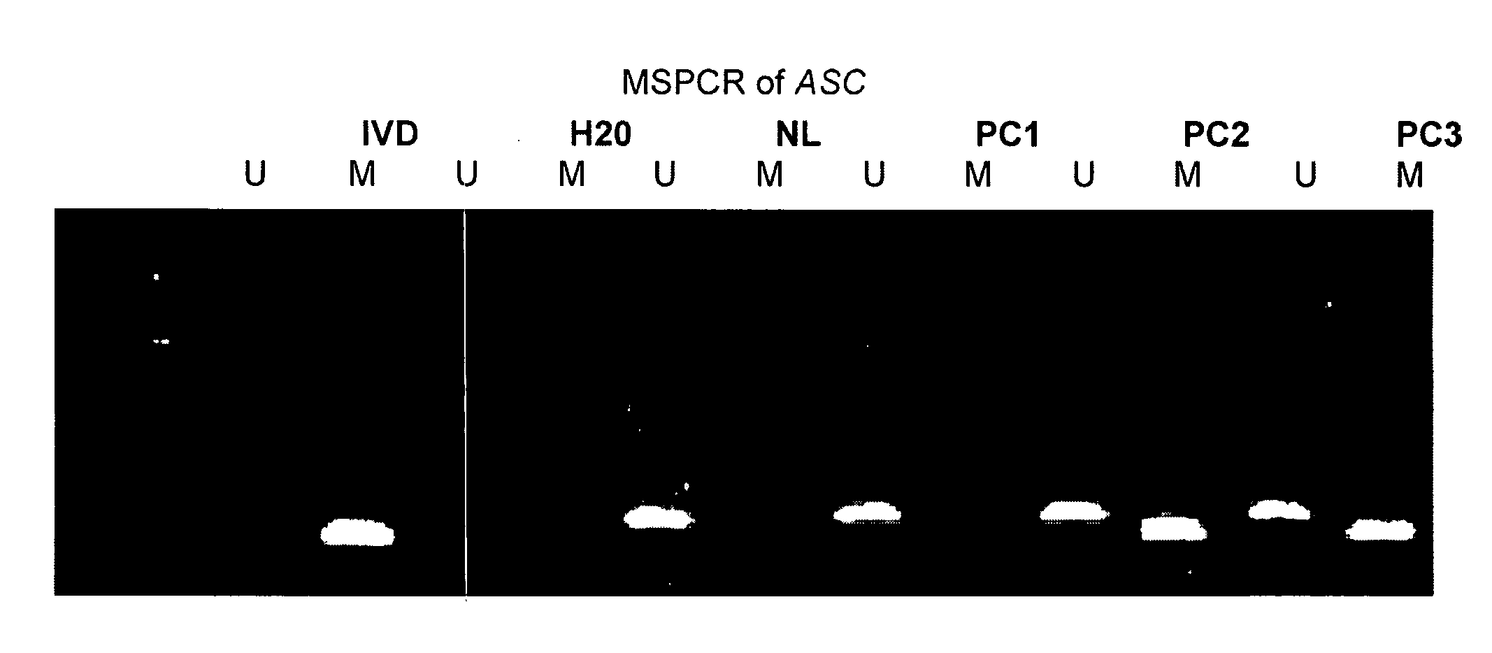 Methylation markers for prostate cancer and methods of use