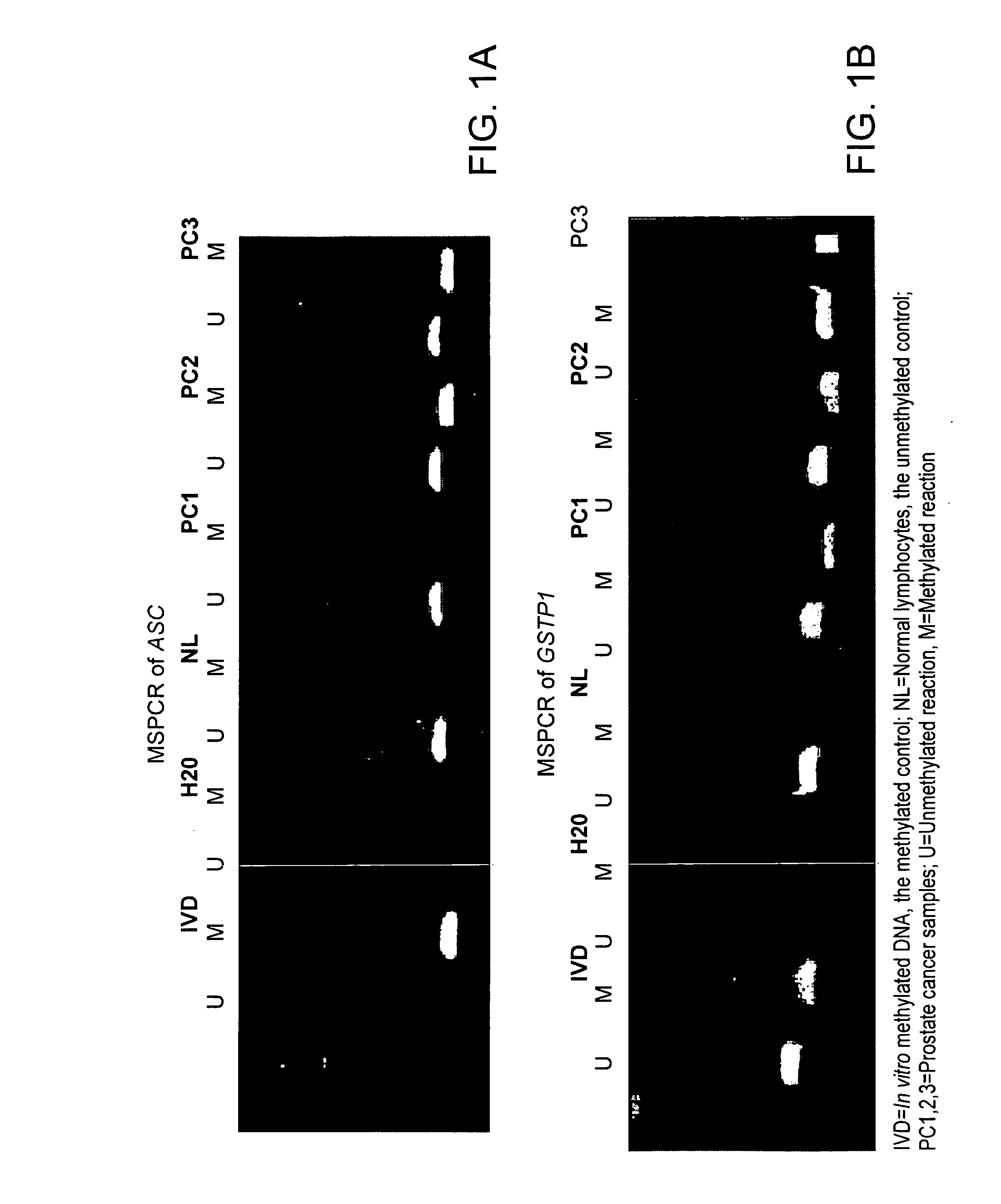 Methylation markers for prostate cancer and methods of use