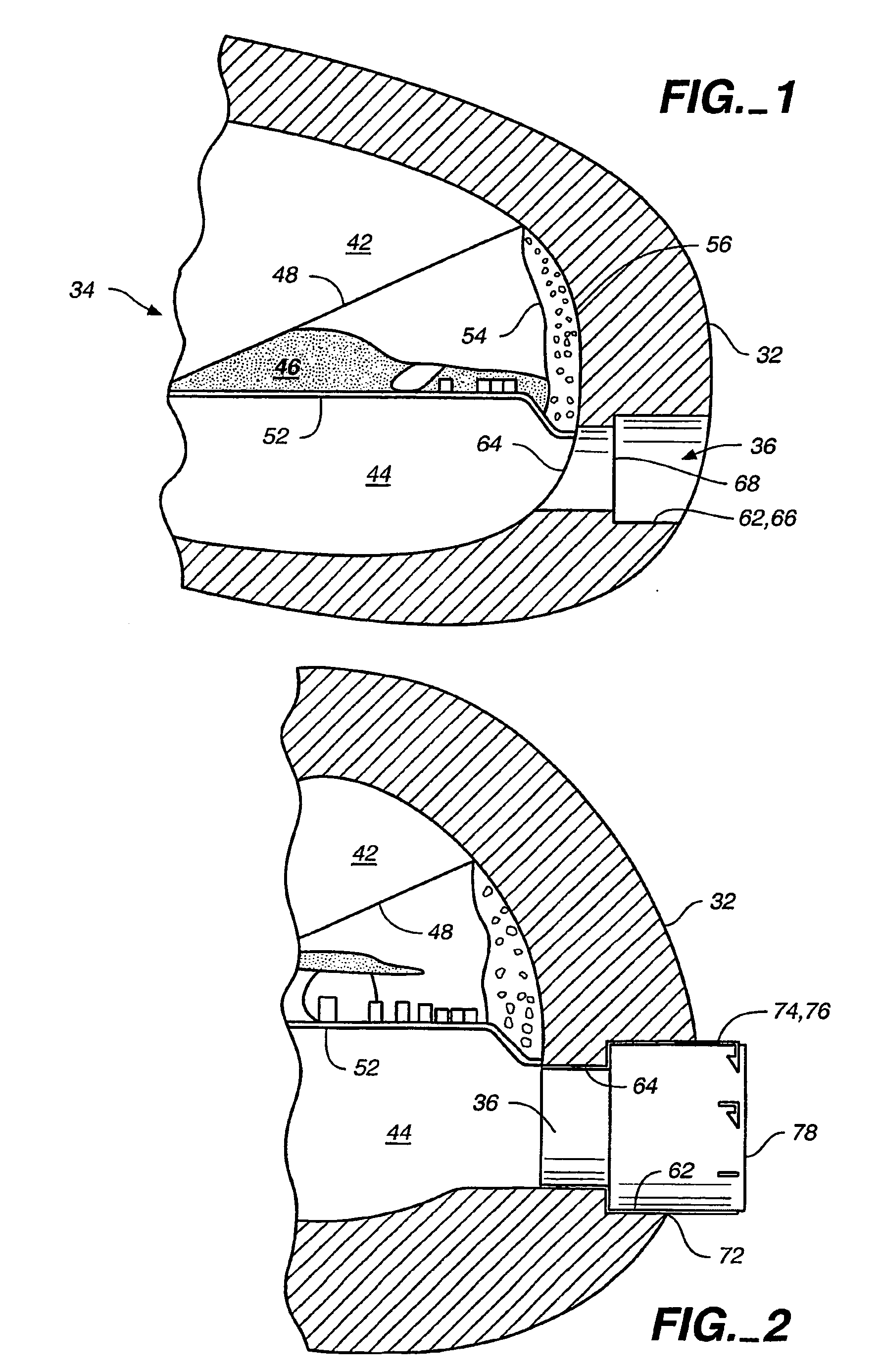 Cochlear fenestration burrs