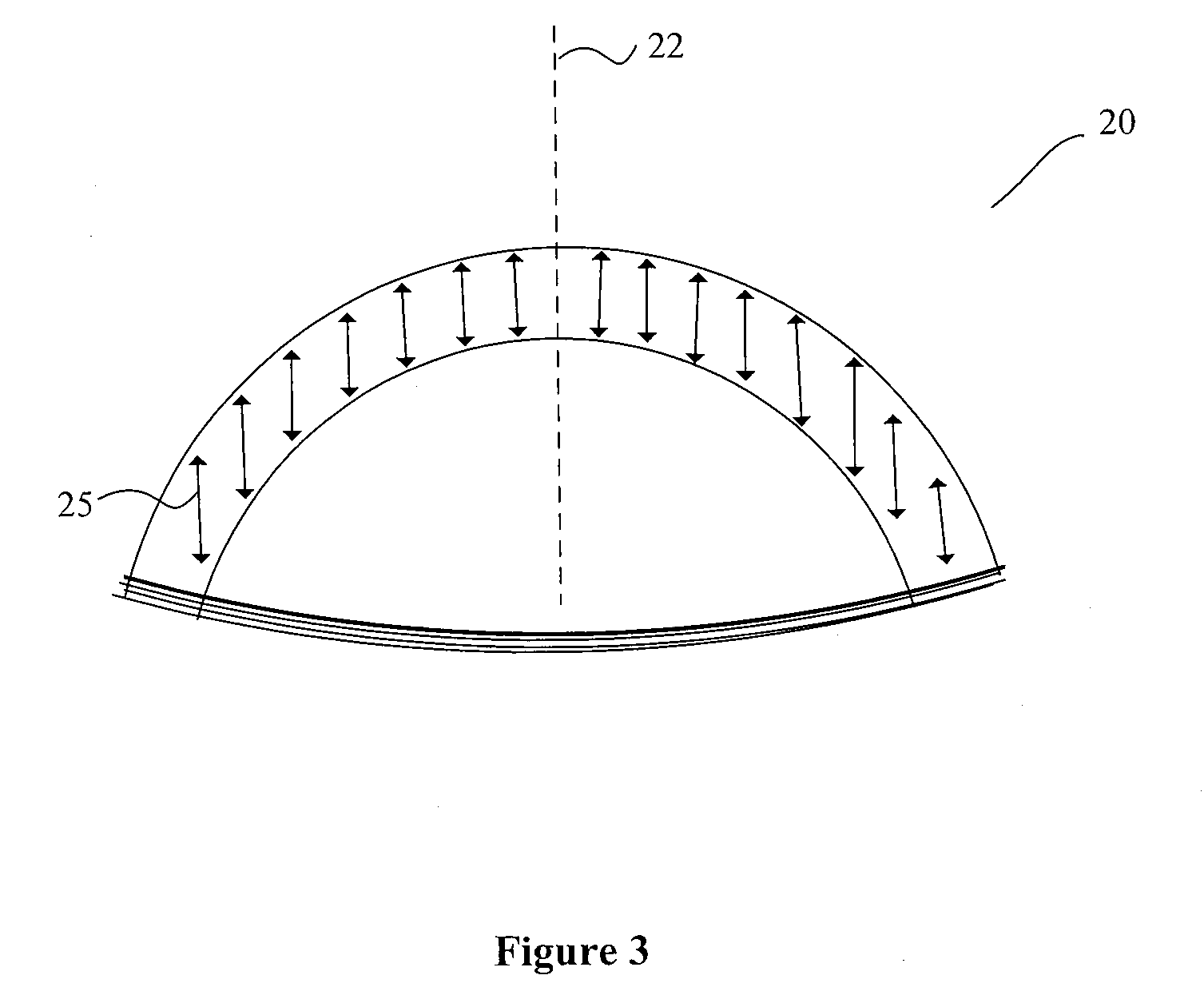 System and method to treat and prevent loss of visual acuity