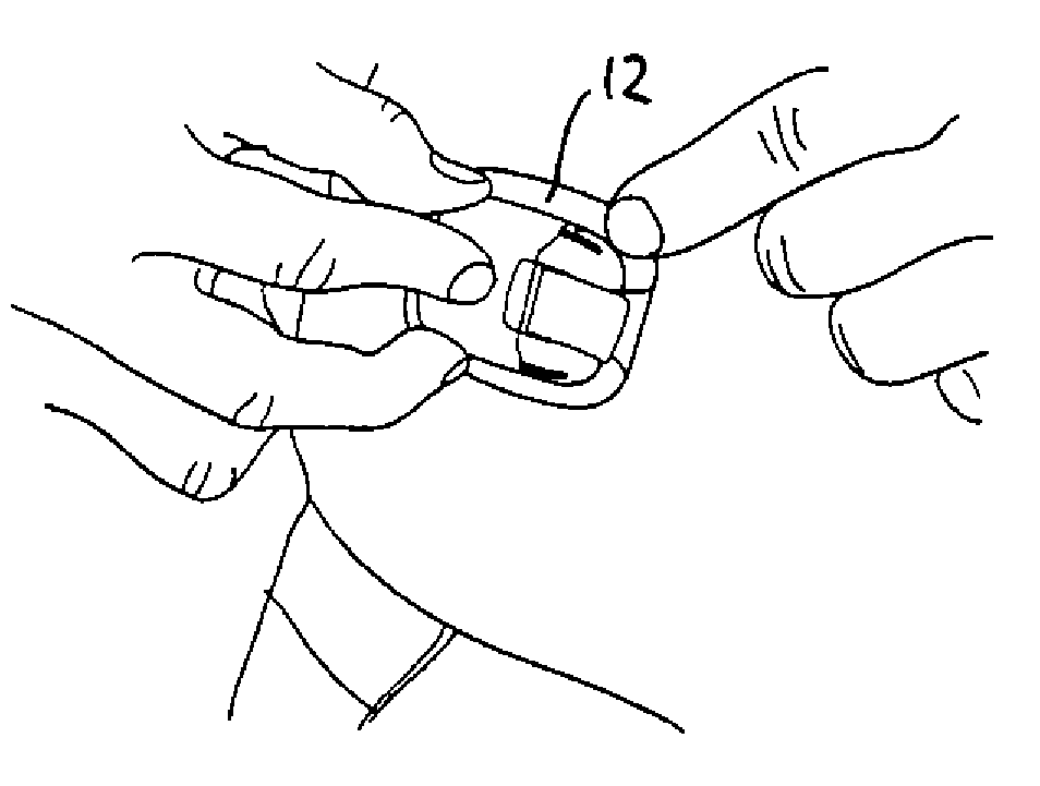 Medical Device with Transcutaneous Cannula Device