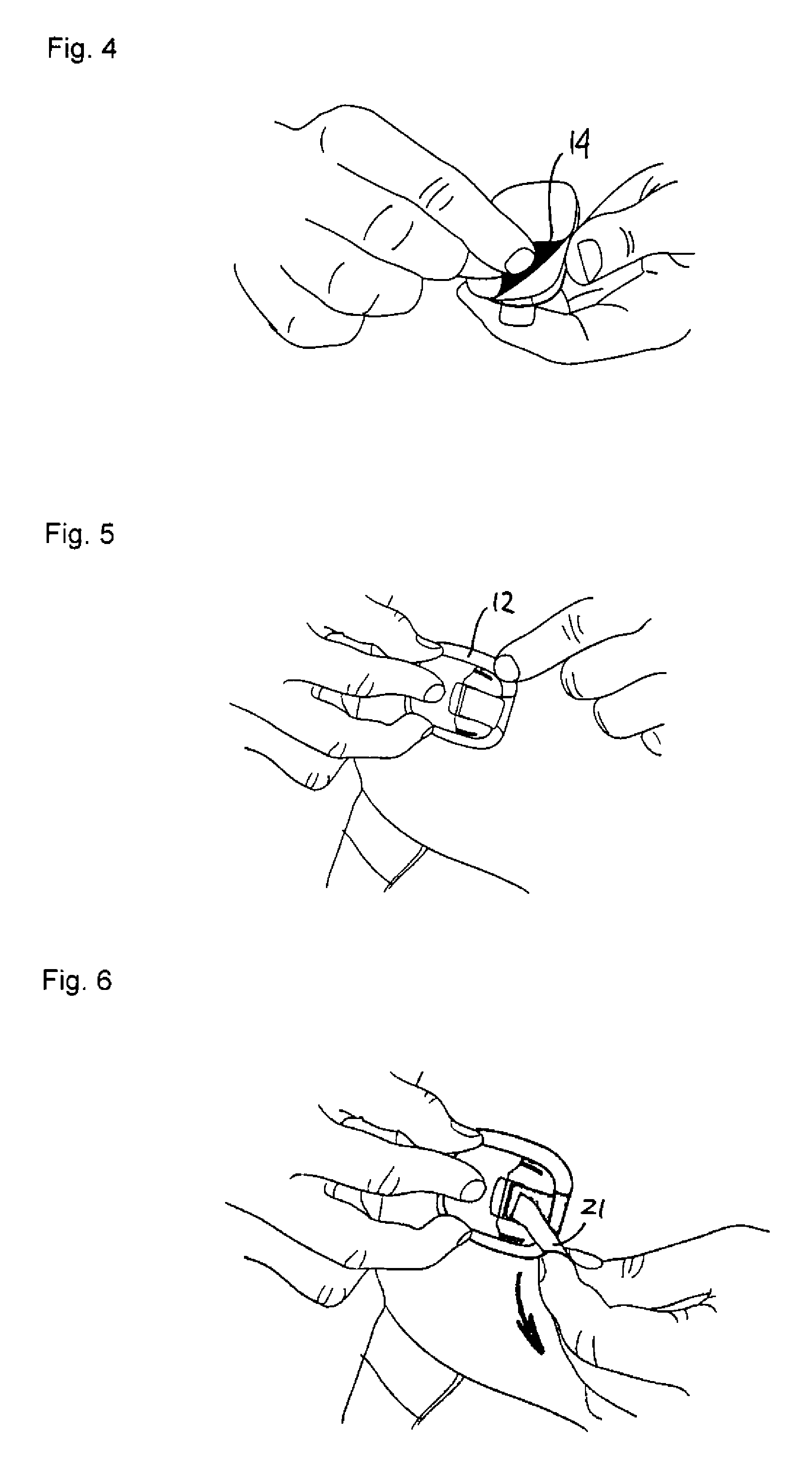 Medical Device with Transcutaneous Cannula Device