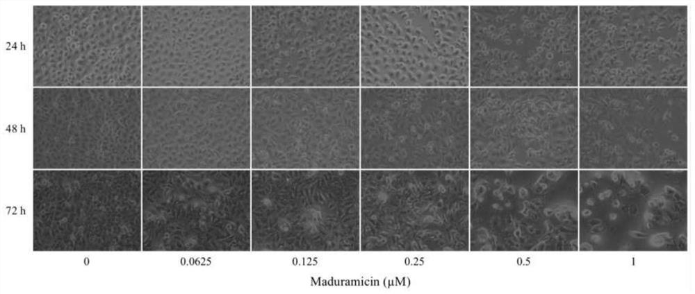 Application of maduramicin ammonium in preparation of anti-breast cancer drugs