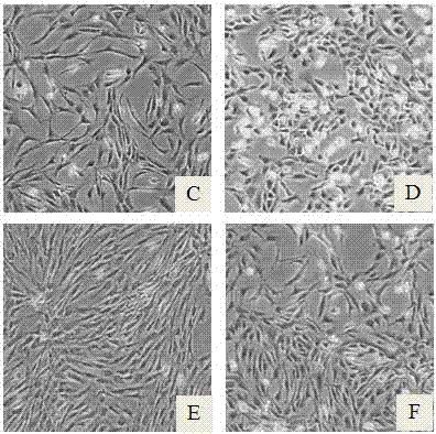 A serum-free chondrocyte culture medium