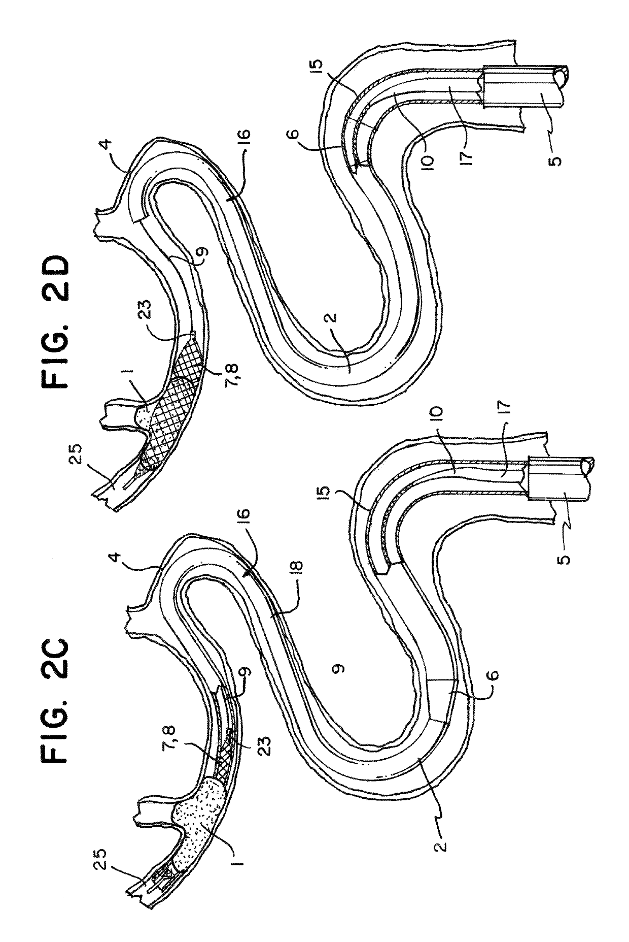 System for removing a clot from a blood vessel