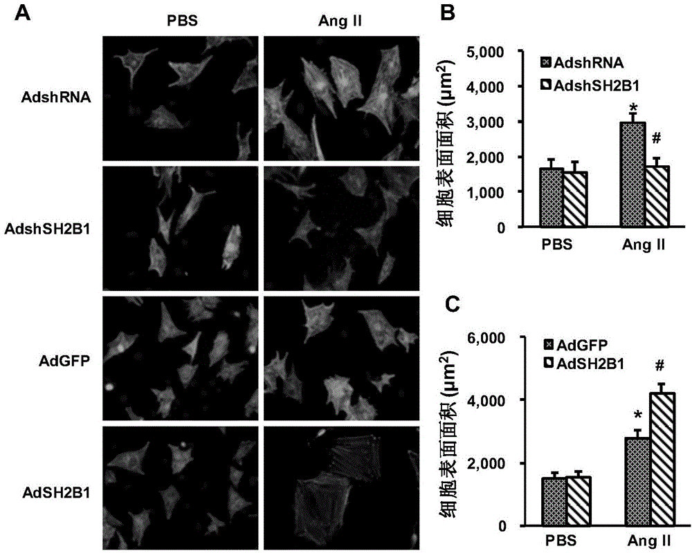 Function and application of SH2B adapter protein 1 (SH2B1) in myocardial hypertrophy treatment