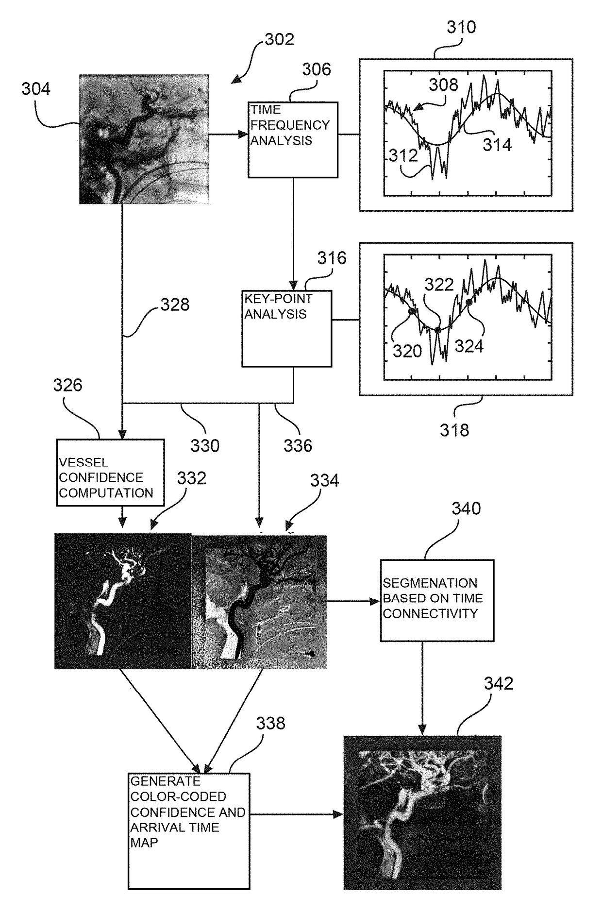 Vessel segmentation