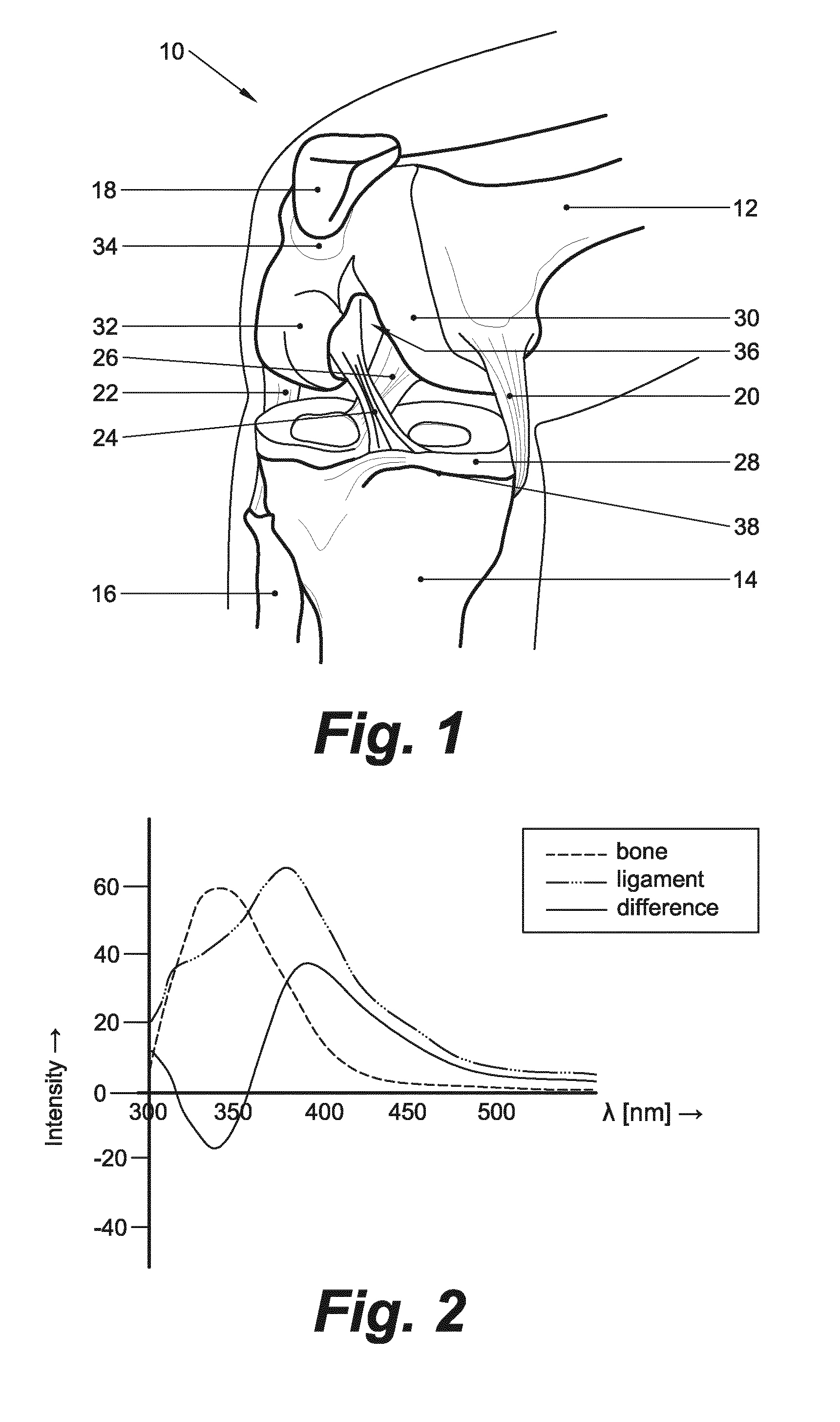 Arthroscopic instrument assembly, and method of localizing musculoskeletal structures during arthroscopic surgery