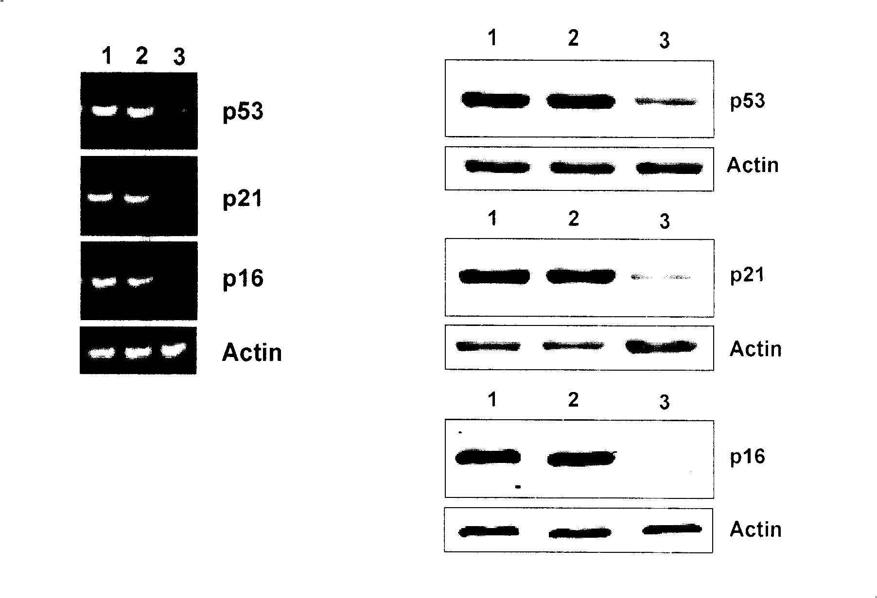 Medicine for treating senile dementia and preparation method thereof