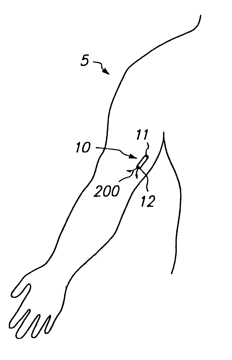 Devices and methods for pain management
