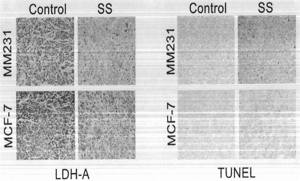 Caulis Spatholobi extract, application thereof and new application of isoliquiritigenin