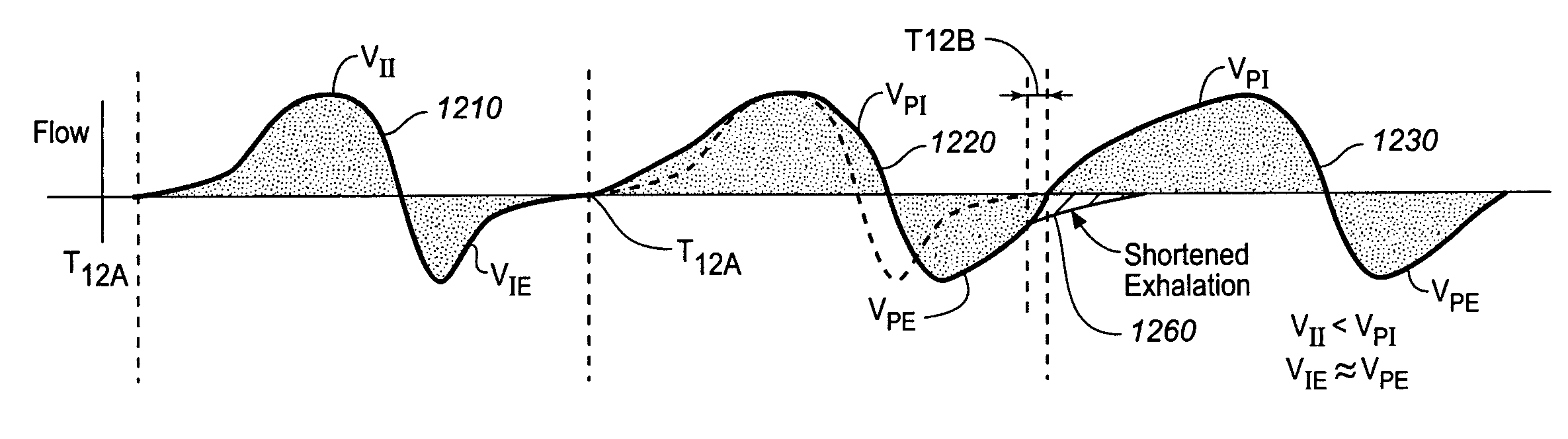 Device and method for manipulating exhalation