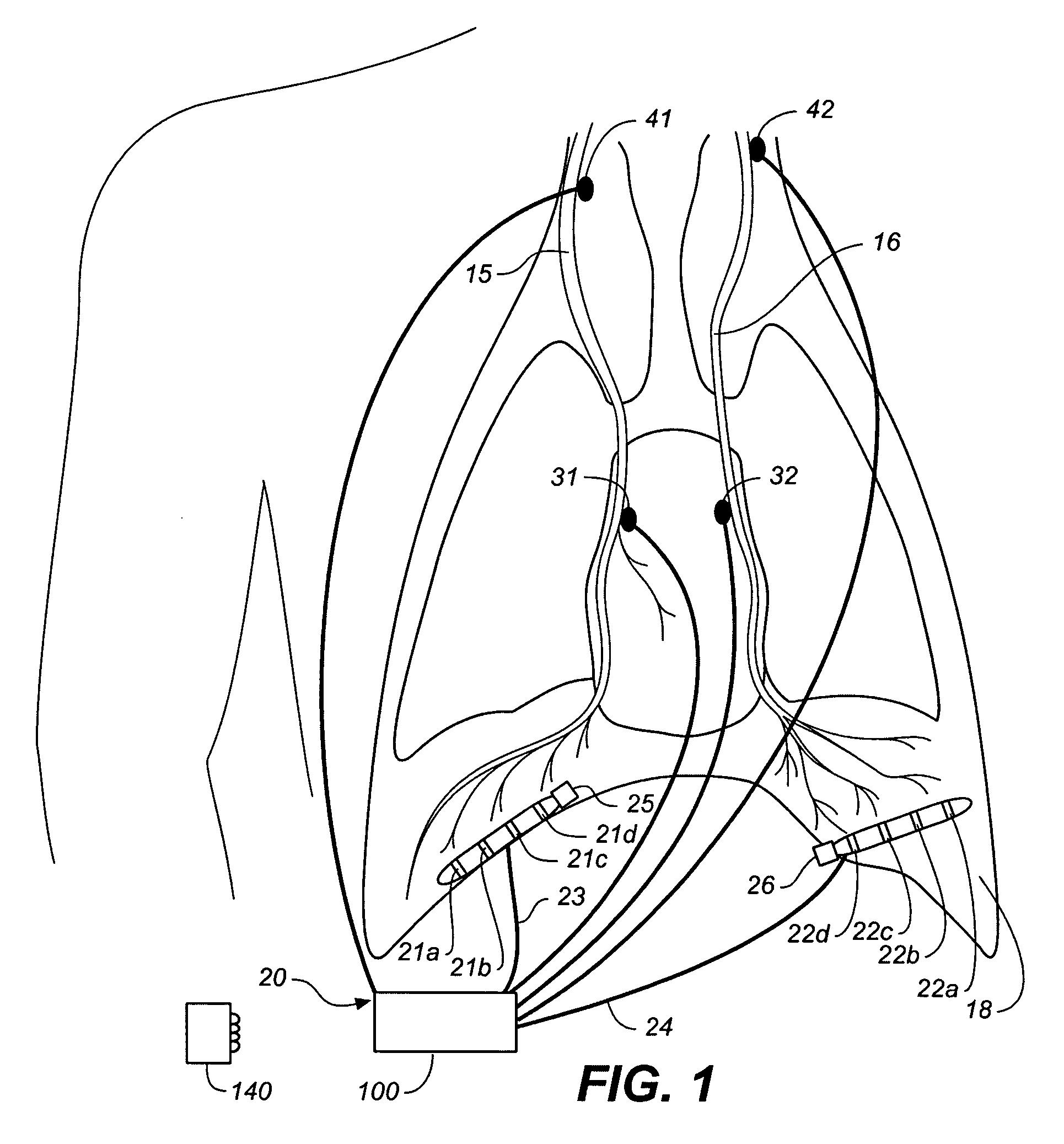 Device and method for manipulating exhalation