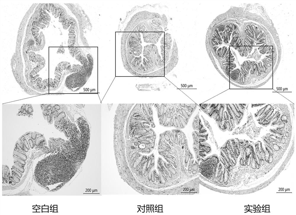 Traditional Chinese medicine composition for treating ulcerative colitis and preparation method of traditional Chinese medicine composition