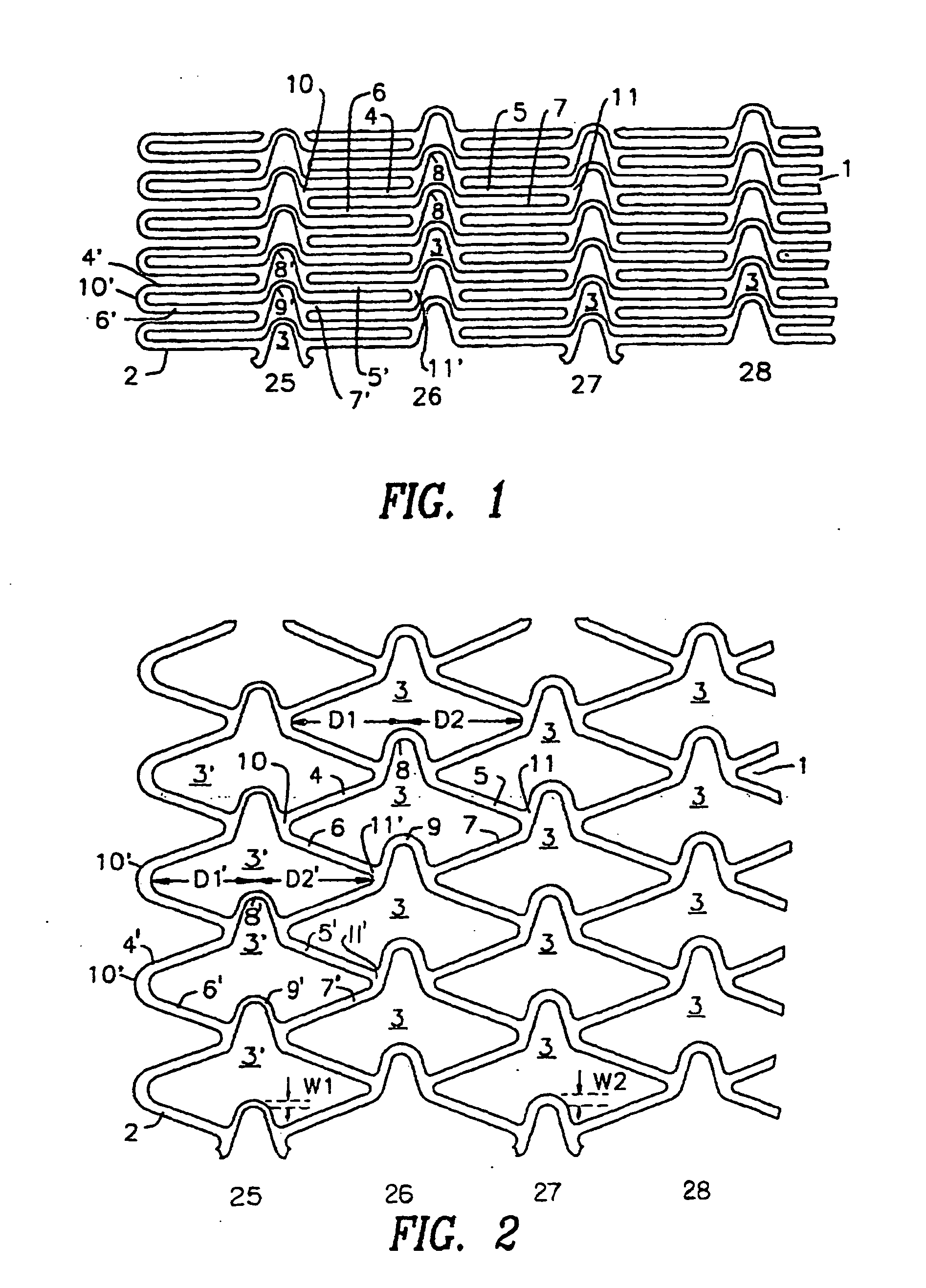 Stent with variable features to optimize support and method of making such stent