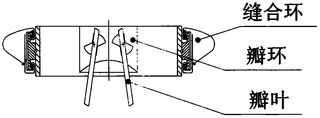 On-ring p heart valve prosthesis