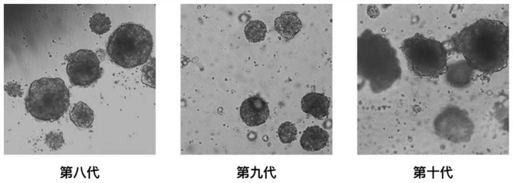Tumor organoid preparation method and device and application thereof