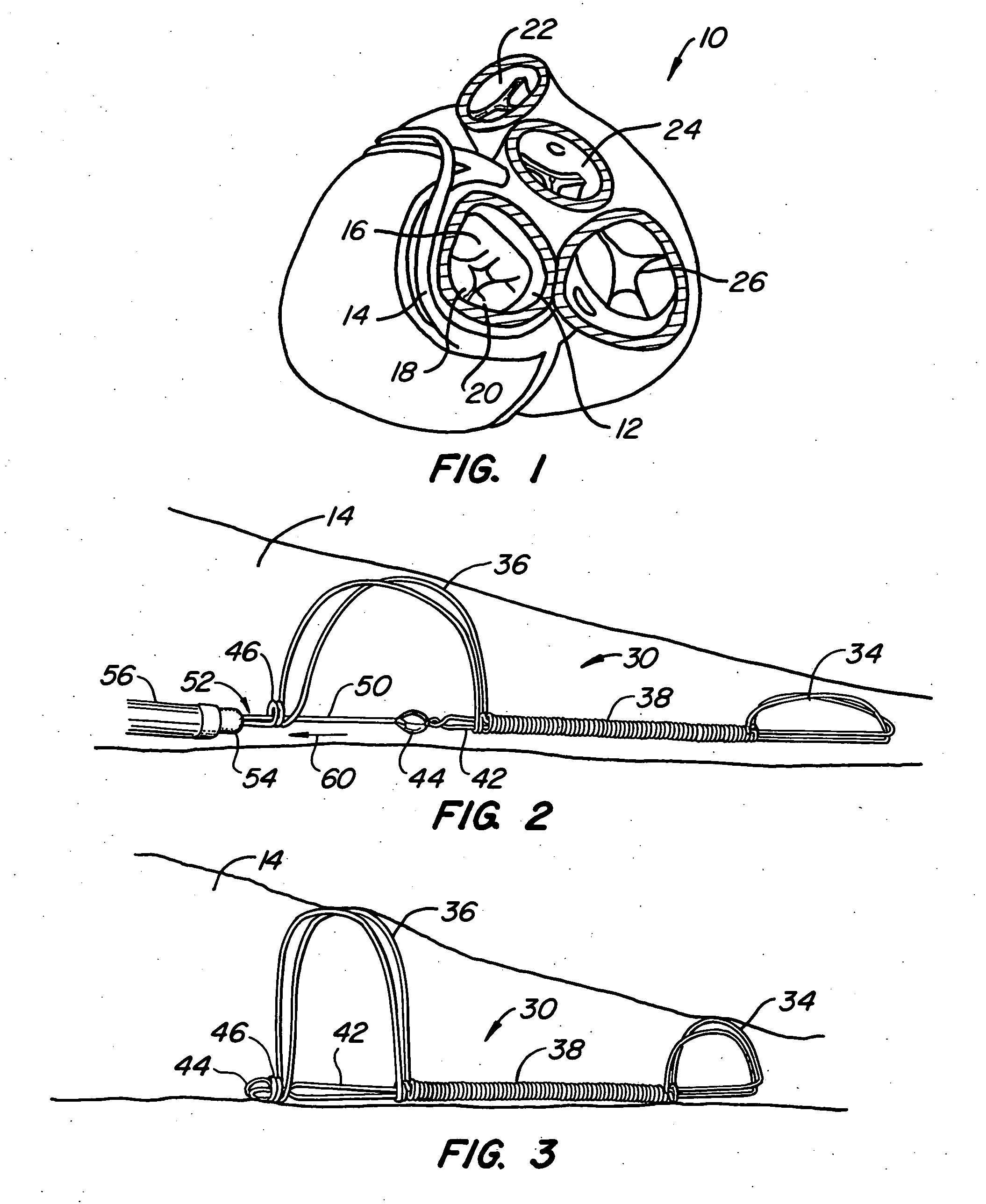 Device, system and method to affect the mitral valve annulus of a heart