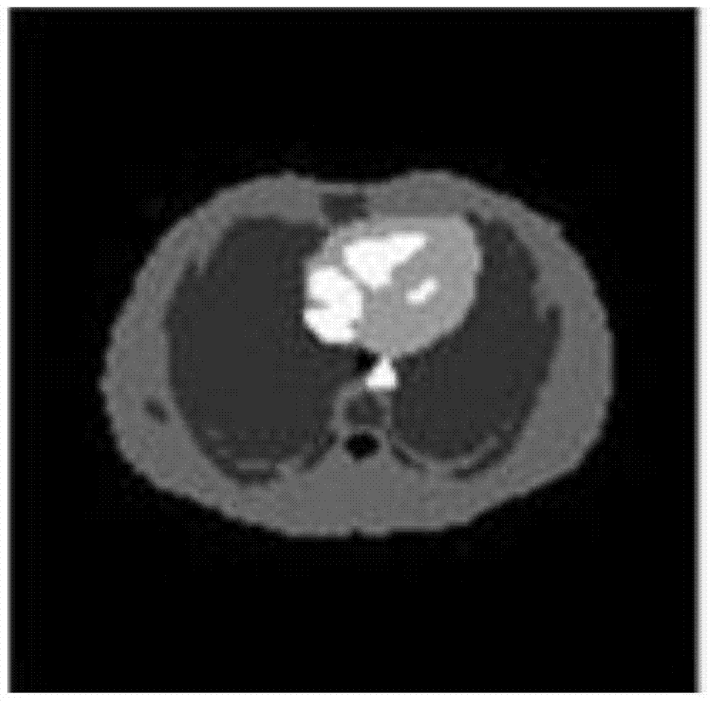 TV-based 3D positron emission tomography (PET) image reconstruction method