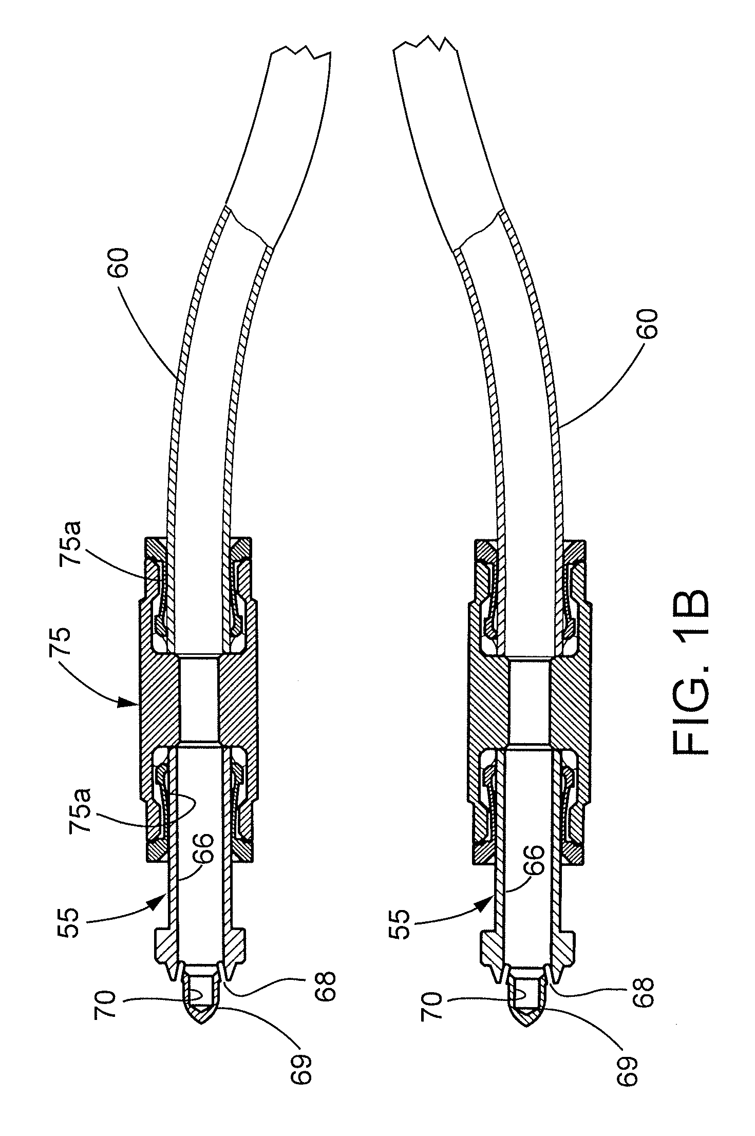 Multiple discharge pressurized air atomization spraying system