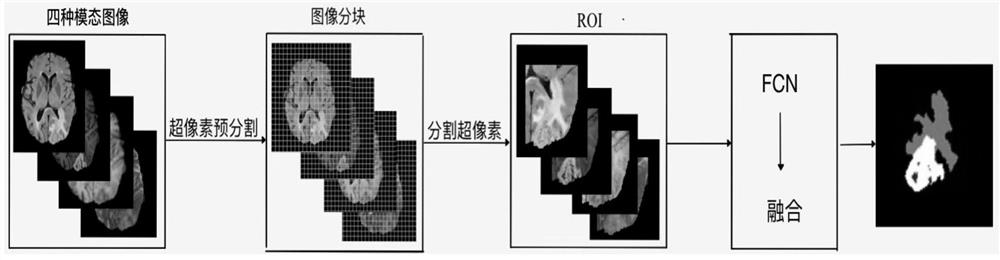 SP-FCN-based MRI brain tumor image segmentation system and method
