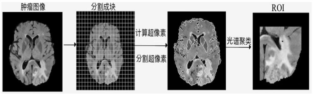 SP-FCN-based MRI brain tumor image segmentation system and method
