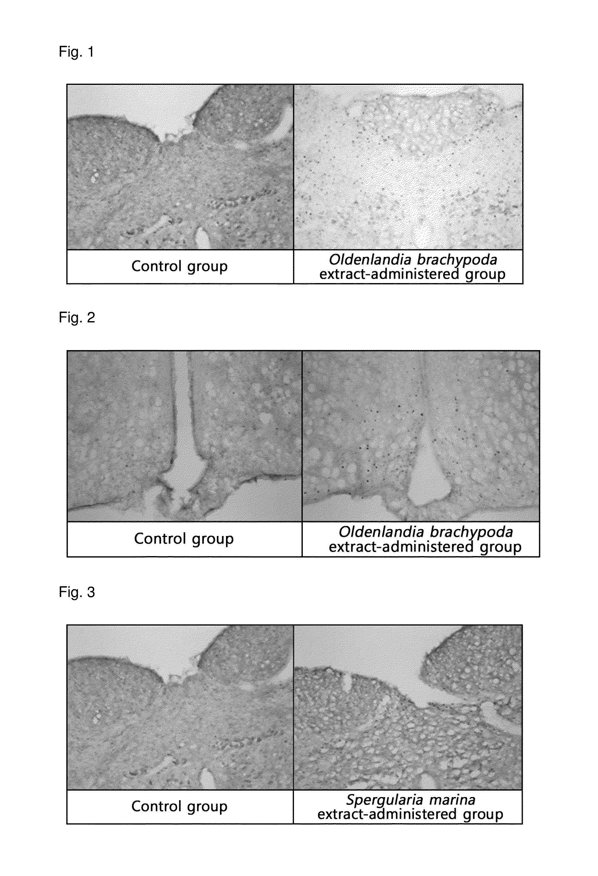 Pharmaceutical or food composition comprising oldenlandia brachypoda, spergularia marina, disporum smilacinum, persicaria posumbu, or geum aleppicum