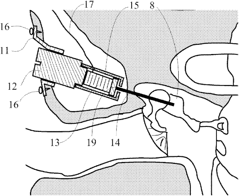 Actuator for hearing compensation and hearing aid device with the same