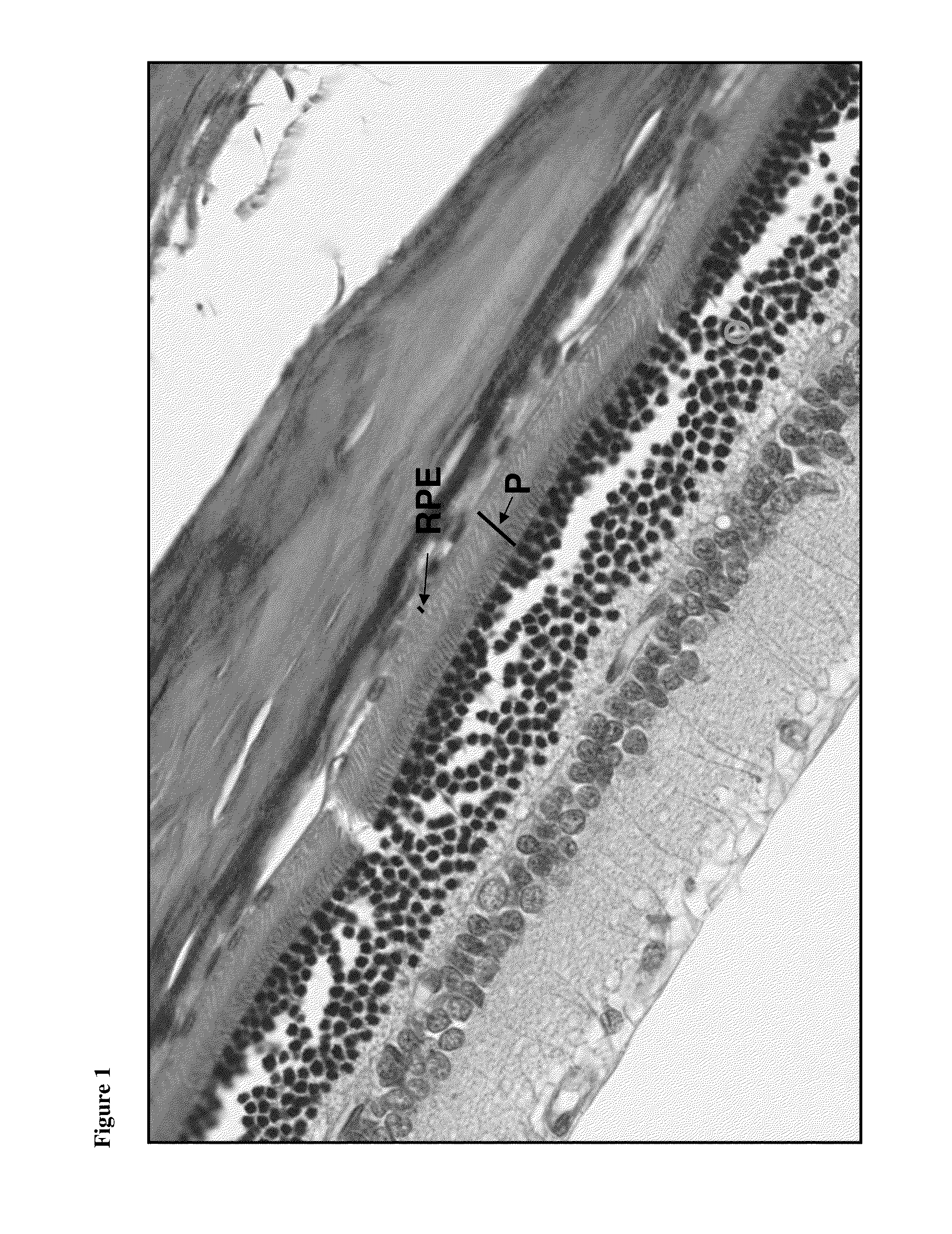 Methods of preventing, reducing or treating macular degeneration