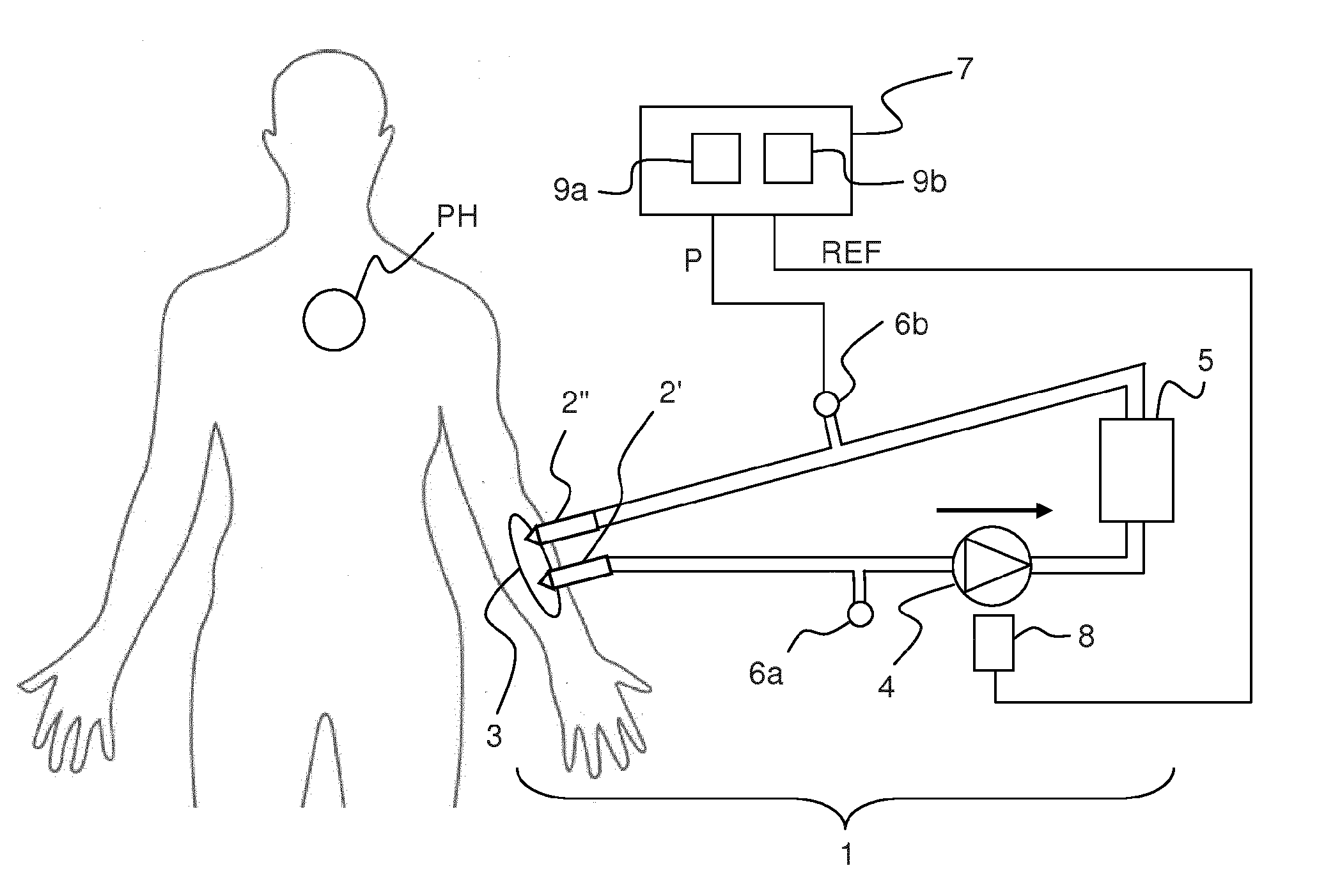 Filtering of pressure signals for suppression of periodic tables