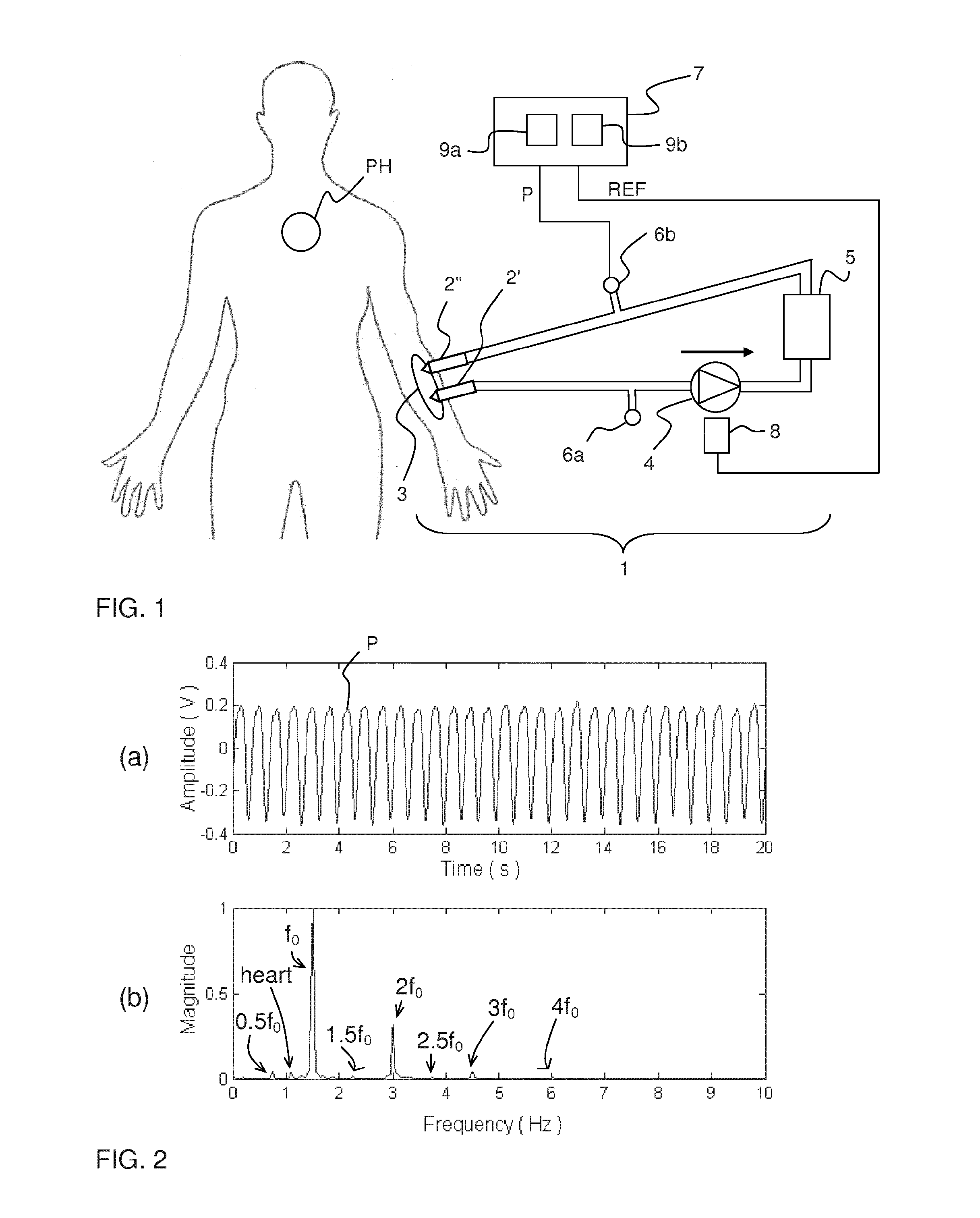 Filtering of pressure signals for suppression of periodic tables