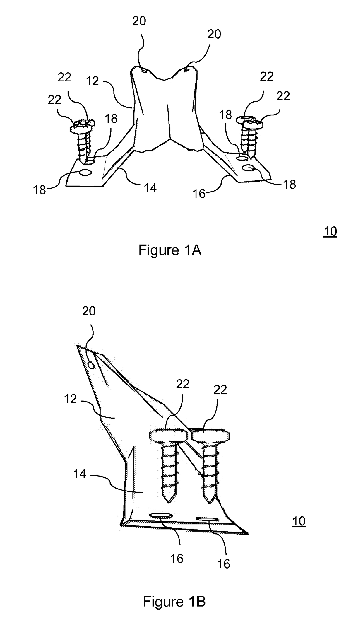 Total artificial spino-laminar prosthetic replacement