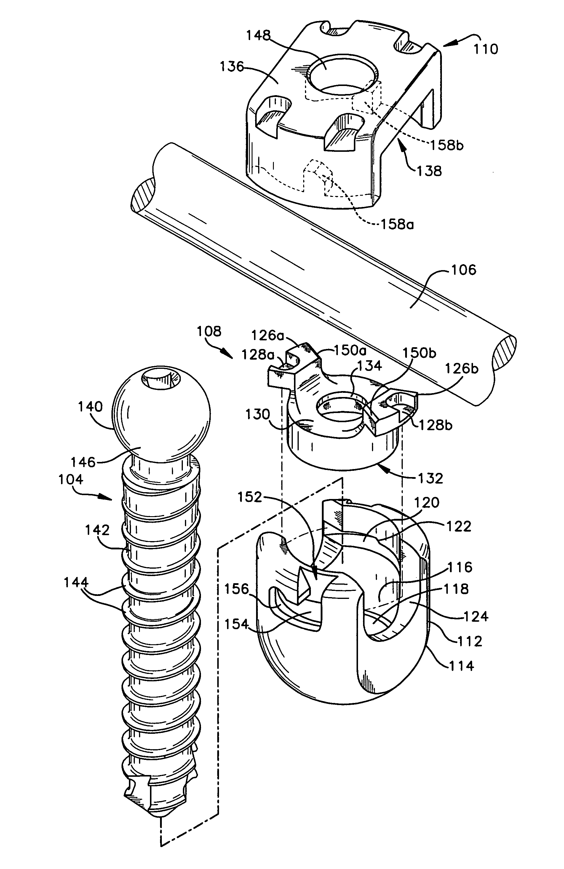 Multistage spinal fixation locking mechanism