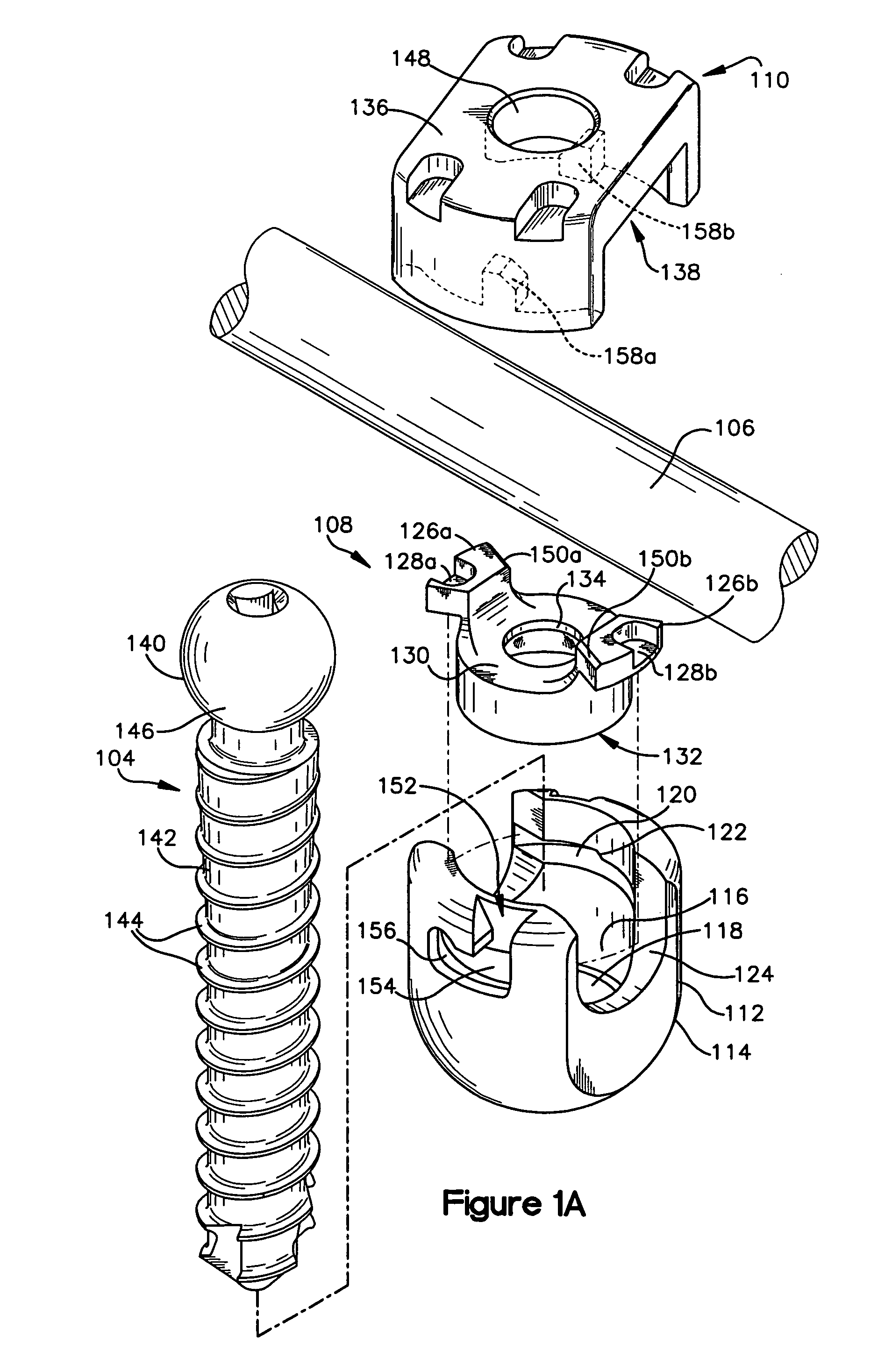 Multistage spinal fixation locking mechanism