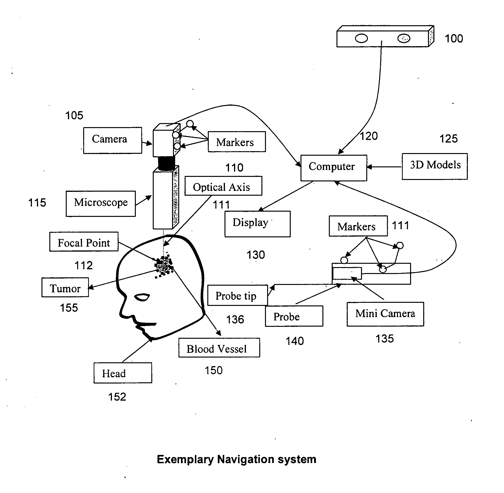Methods and apparati for surgical navigation and visualization with microscope ("Micro Dex-Ray")