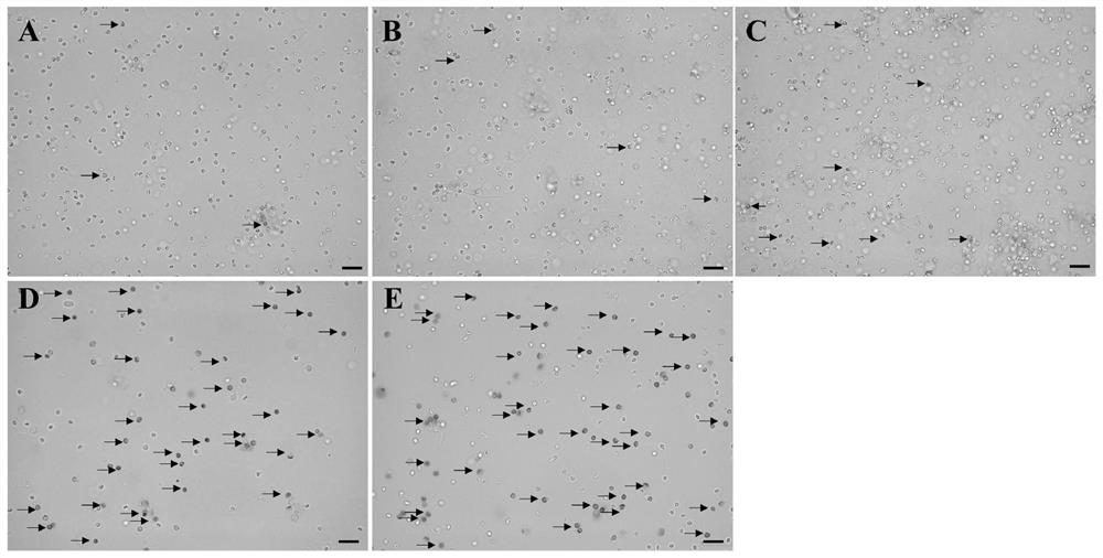 Sperm cryopreservation liquid and application in sperm cryopreservation of bostrichthys sinensis