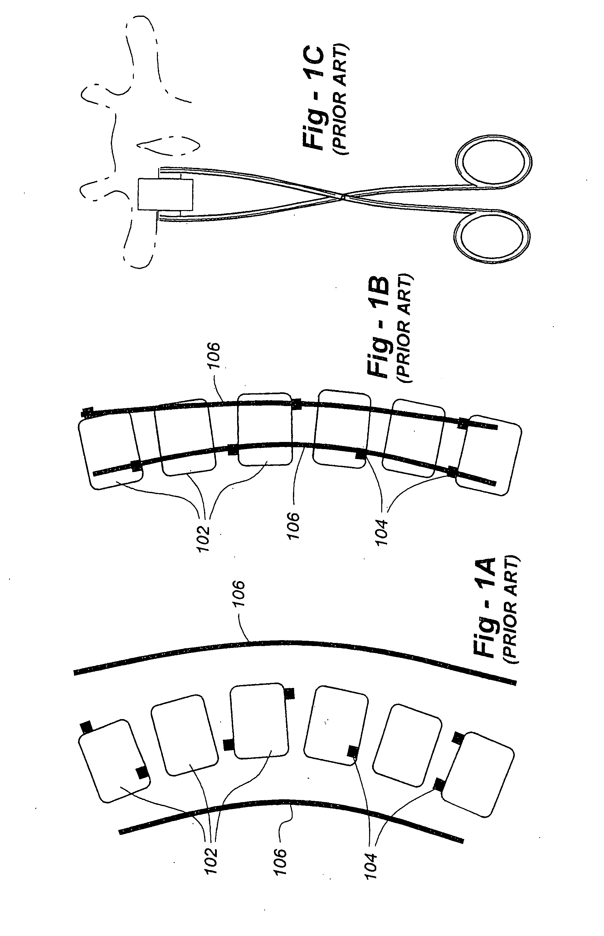 Spinal alignment system and related methods
