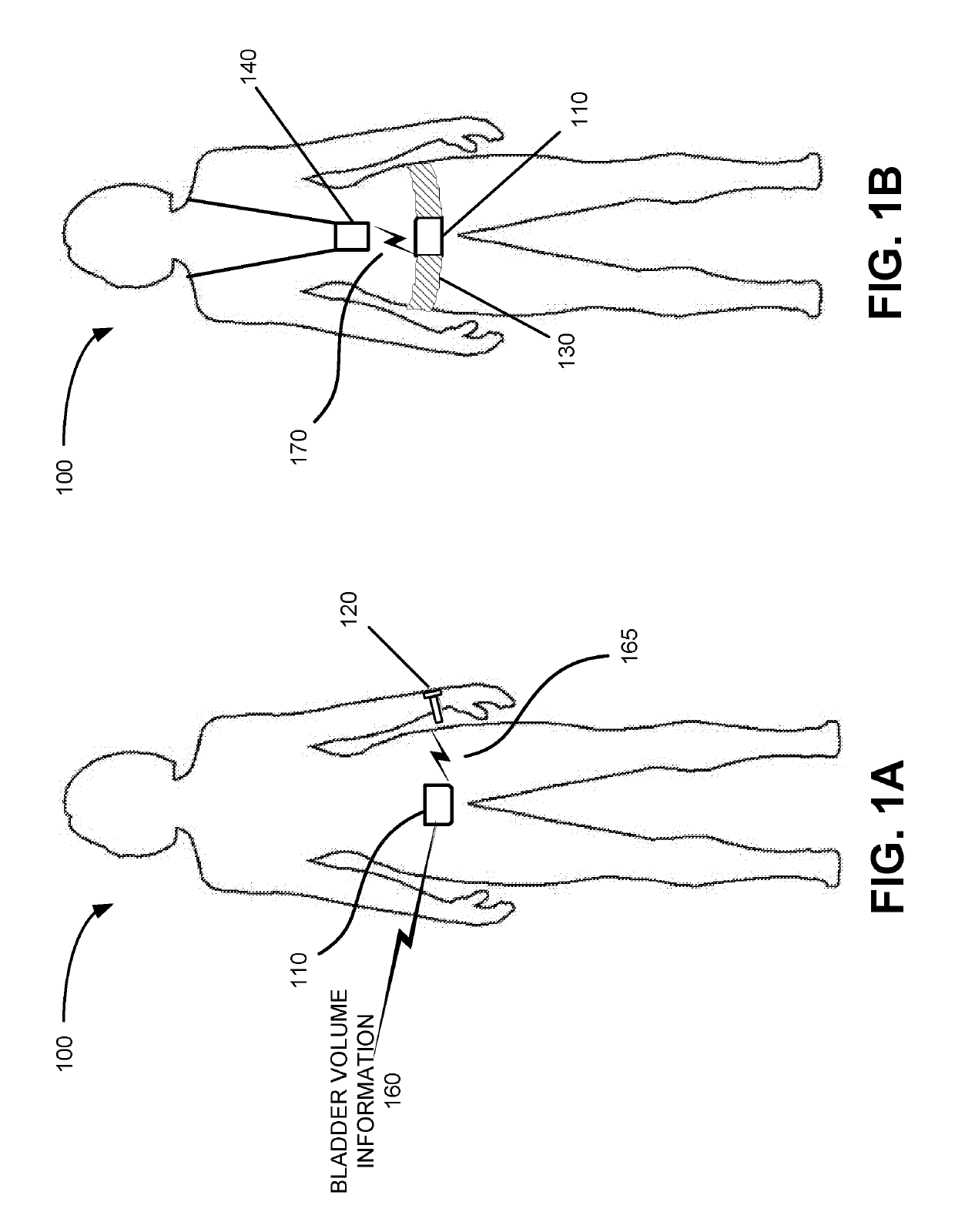Systems and methods for bladder health management