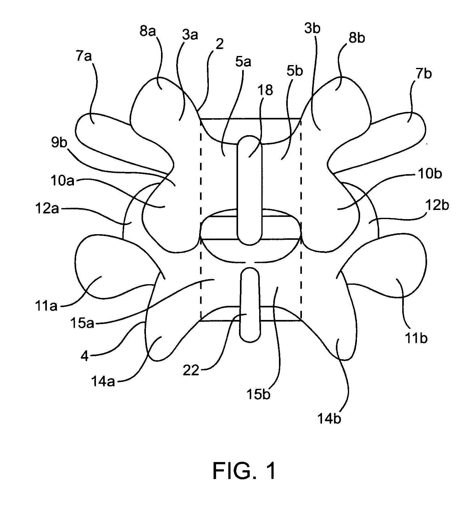 Systems and methods for posterior dynamic stabilization of the spine