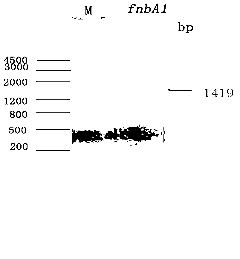 Methicillin-resistant staphylococcus aureus (MRSA) vaccine recombinant protein FnbA1 and preparation method and application thereof