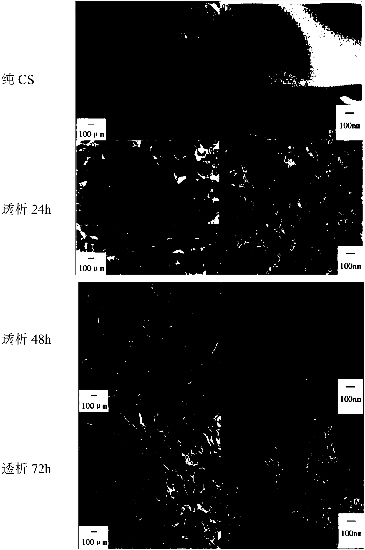 Nanometer hydroxyapatite/chitosan porous composite scaffold material as well as bionic dialysis mineralization preparation method and application thereof