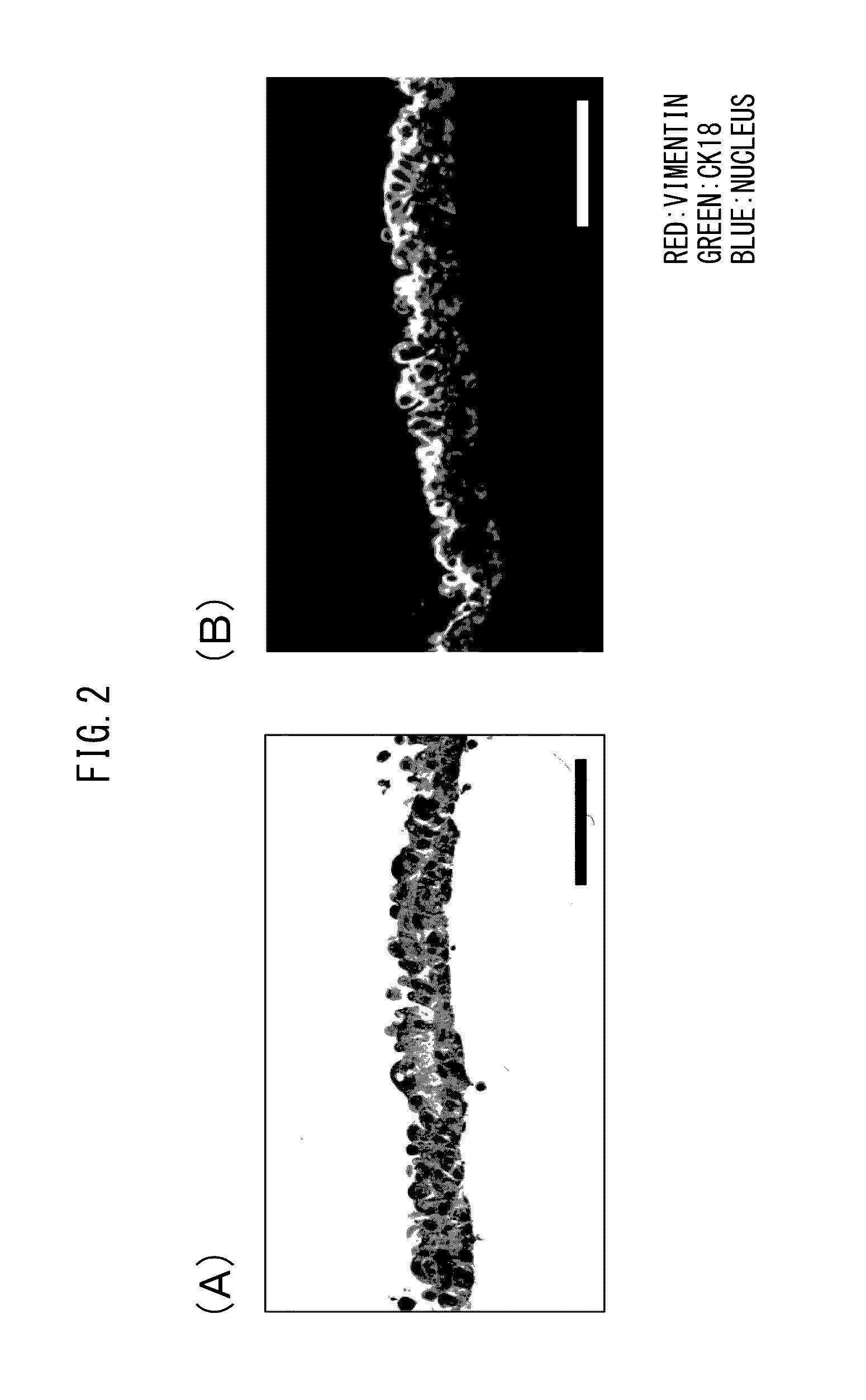 Cell composition for treatment of uterine tissue and method for producing same